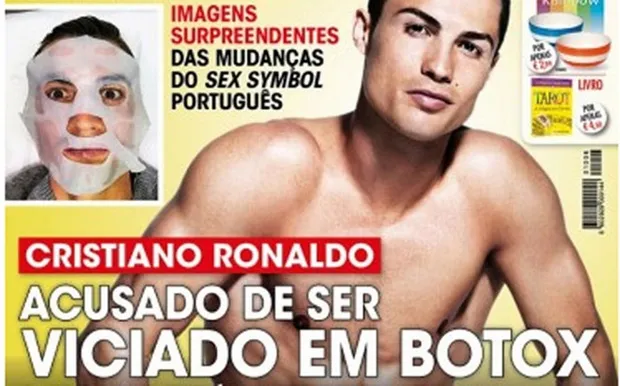 ronaldo-botox-1477386390527