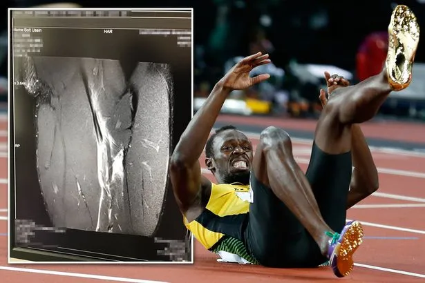 Usain Bolt lỡ cơ hội khoác áo Quỷ đỏ - Bóng Đá