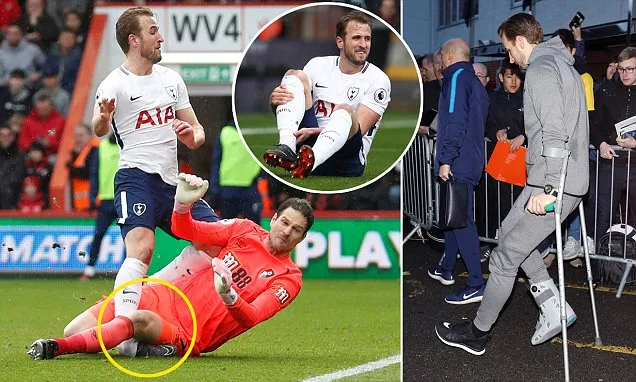 Đứt dây chằng, Harry Kane nguy cơ lỡ World Cup - Bóng Đá