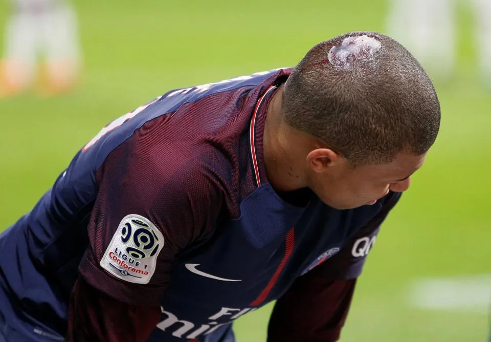 CẬN CẢNH: Mbappe thương tích đầy mình sau trận thua Lyon - Bóng Đá