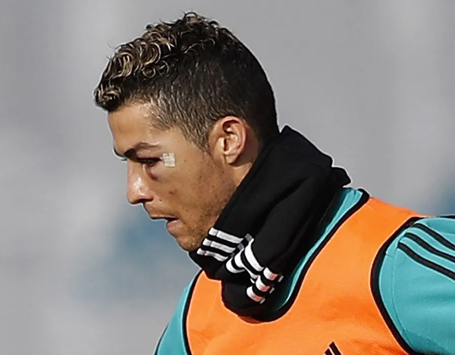 Ronaldo mắt sưng to trong buổi tập mới nhất của Real Madrid - Bóng Đá