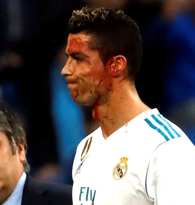 Cực hài: Ronaldo mượn điện thoại bác sĩ soi vết thương - Bóng Đá