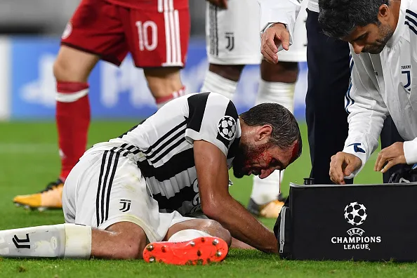 Chấm điểm Juventus sau trận Olympiacos: Không phải Higuain, đây mới là người đóng thế hoàn hảo - Bóng Đá