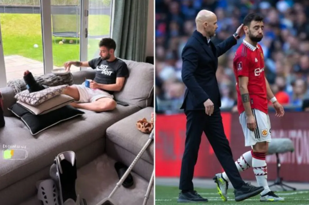 Bruno Fernandes to miss Manchester United games against Tottenham and potentially Aston Villa - Bóng Đá