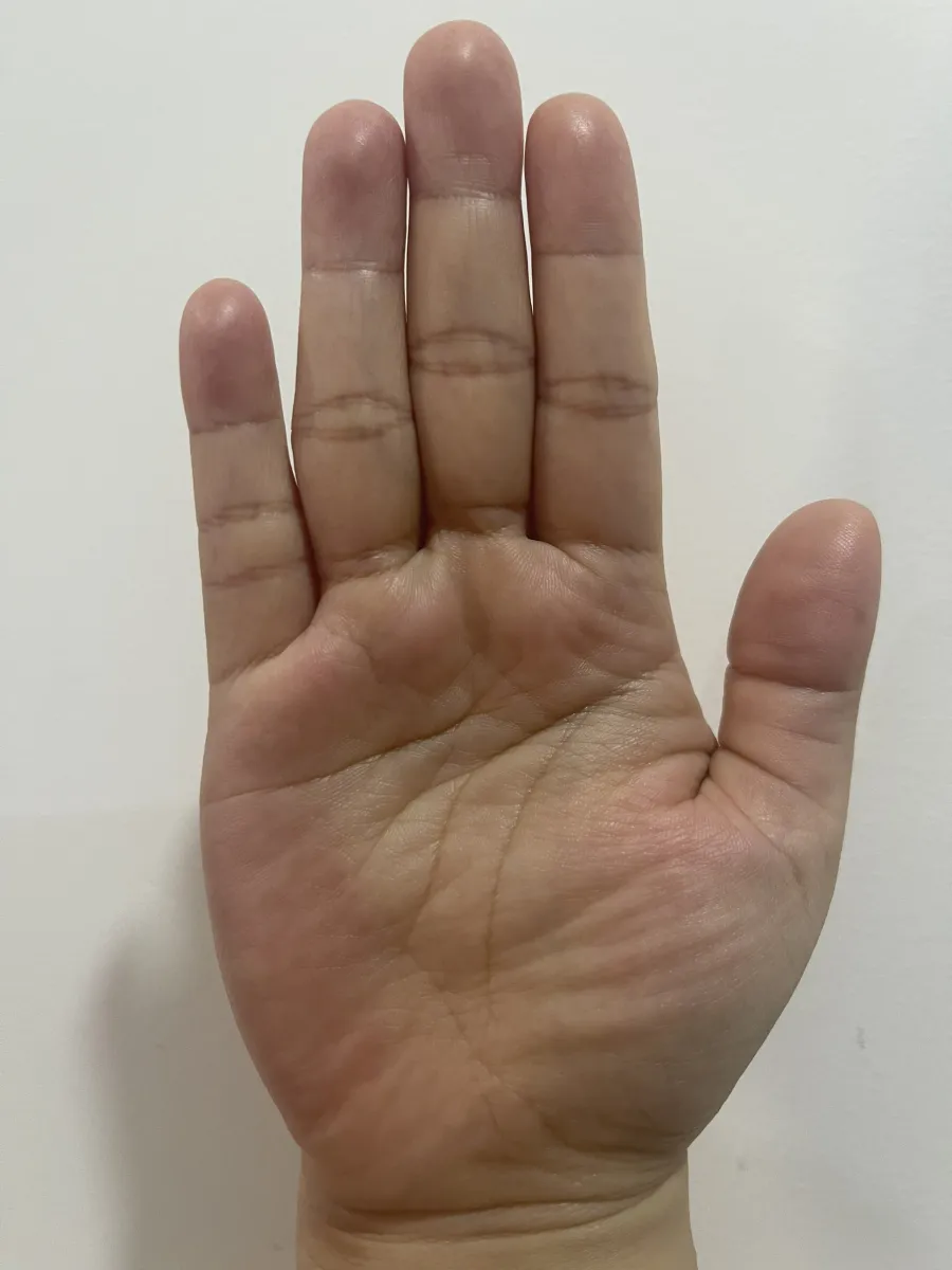 Độ rõ nét trong các đường vân tay có thể phản ánh trạng thái sức khỏe tổng quát của một cá nhân