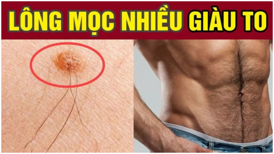 Mọc lông ở vị trí này hút lộc