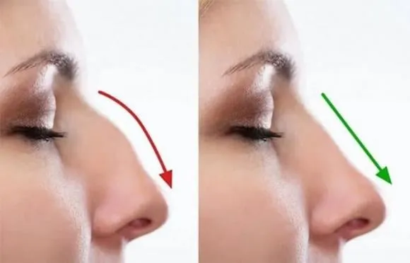 Thực tế, phụ nữ với chiếc mũi to thường được tôn vinh trong nghệ thuật và văn hóa. 
