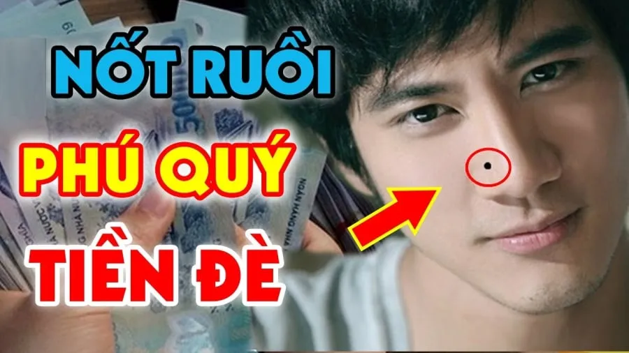 Nốt ruồi tiền đè