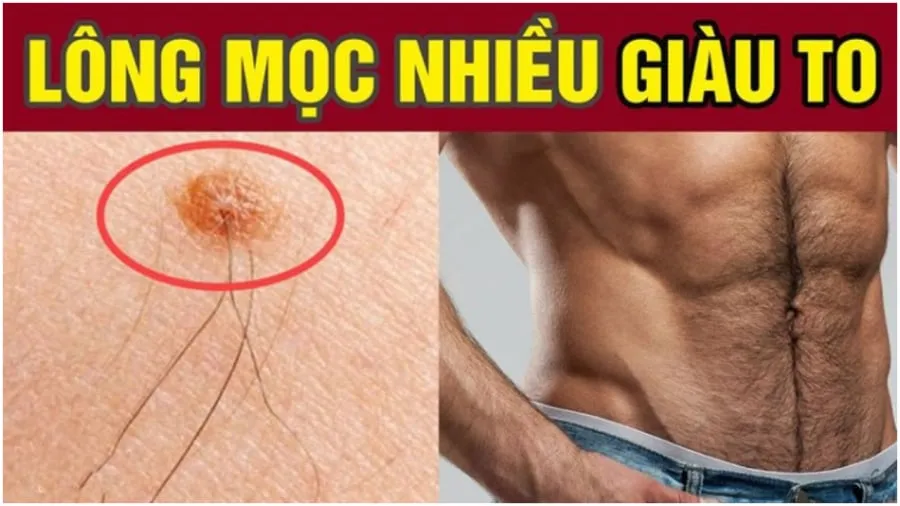 Vị trí này mọc lông ngồi không cũng có lộc