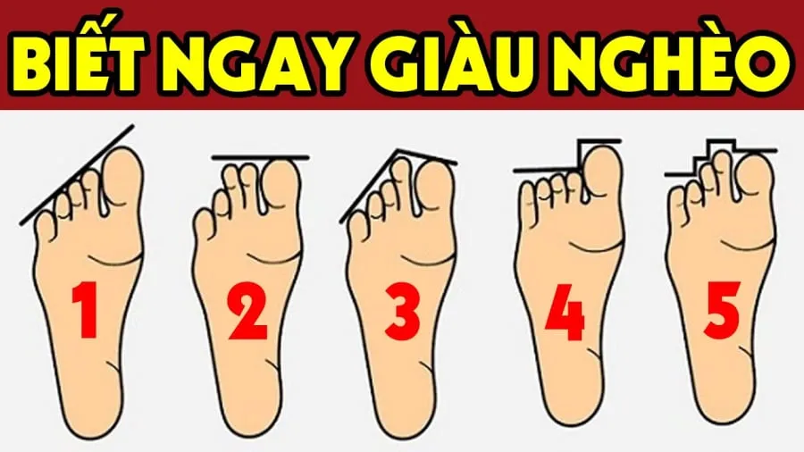 Tướng bàn chân giàu có