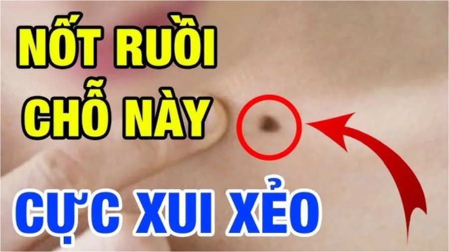 3 vị trí nốt ruồi trên mặt hao tài tán lộc