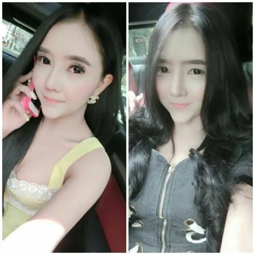 Thiếu nữ đen đúa hóa hot girl trắng ngần nhờ “dao kéo”