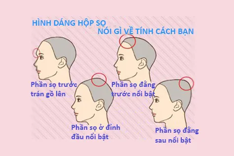 Nhìn hình dáng hộp sọ, đoán tính cách chủ nhân