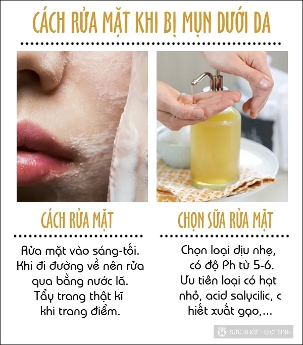 trị mụn 