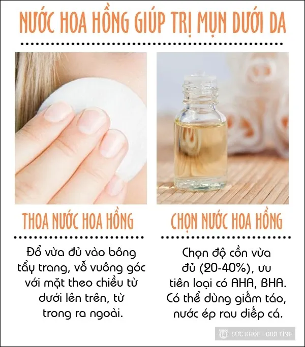 trị mụn 