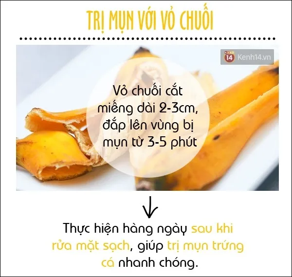 mặt nạ 