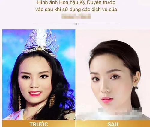 Kỳ duyên thẩm mỹ 