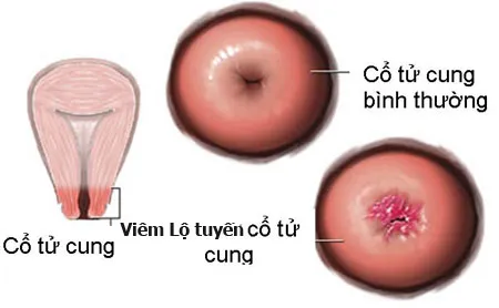 Mô tả ảnh.