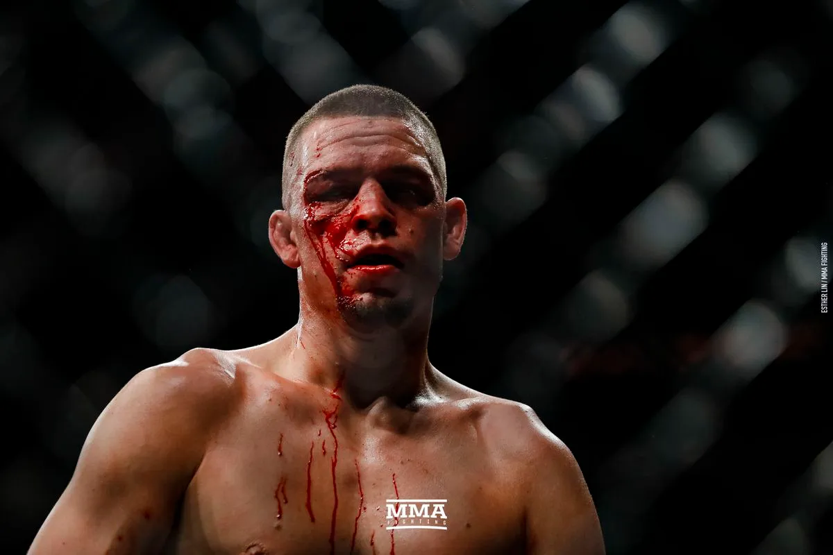 Káº¿t quáº£ hÃ¬nh áº£nh cho nate diaz vs masvidal