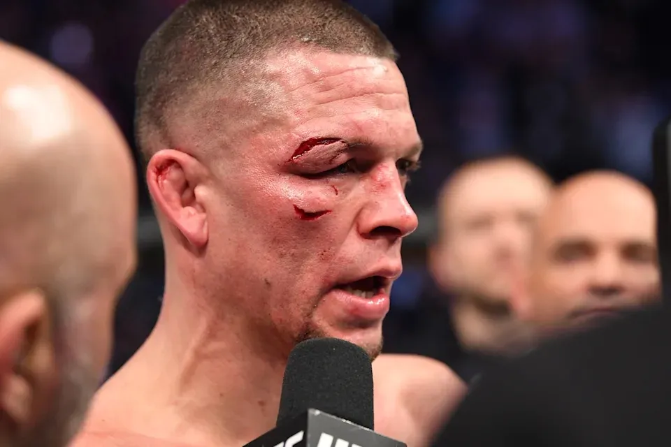 Phản ứng của Nate Diaz sau khi Francis Ngannou tự vấn chuyện lương bổng ở UFC