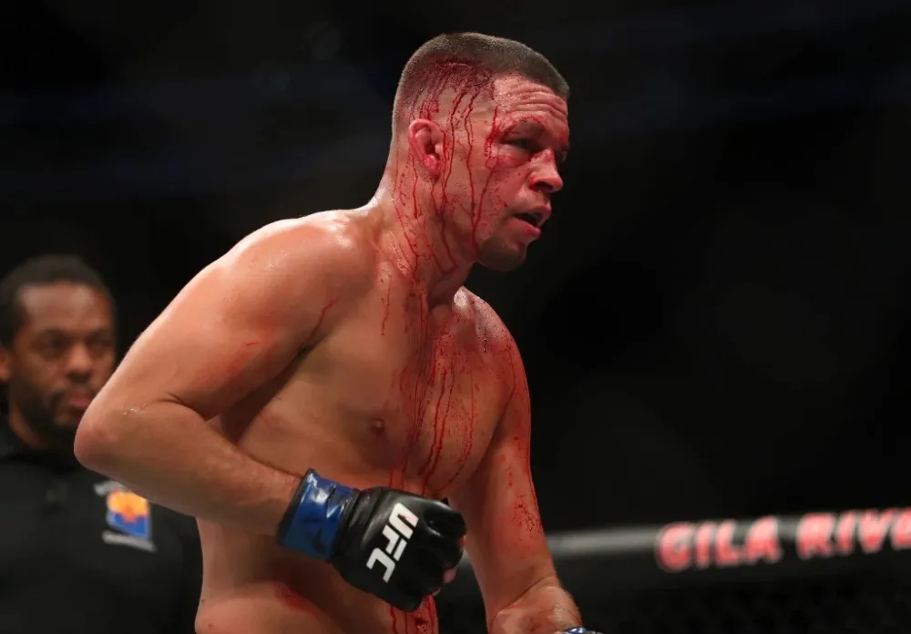 Nate Diaz là 'võ sĩ đường phố đáng sợ nhất MMA'