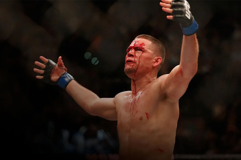 Nate Diaz lên kế hoạch trở lại lồng bát giác trong năm nay.