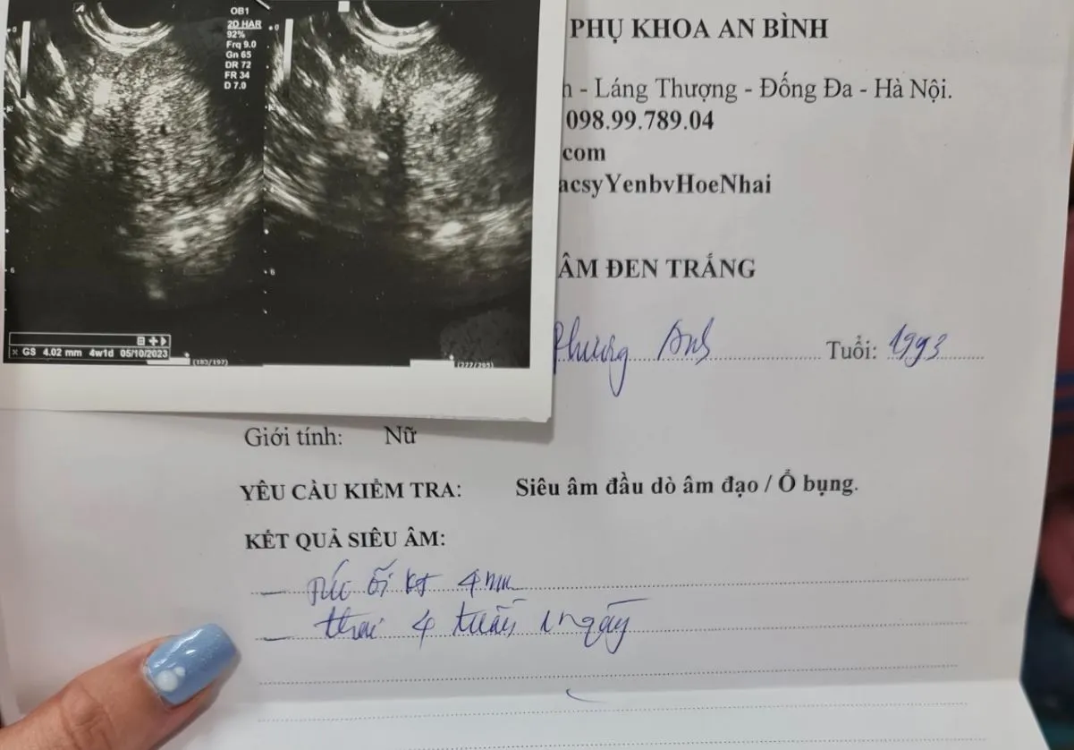 nguoi-phu-nu-bi-danh-say-thai-vi-tranh-chap-cho-do-xe-2