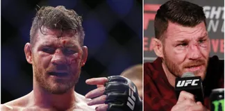 Michael Bisping tổn thương mắt nghiêm trọng sau khi bị Vitor Belfort đánh gục năm 2013.