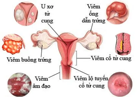 phu-nu-nhat-ban-ca-doi-khong-lo-mac-benh-phu-khoa-nho-4-bi-quyet-nay-1