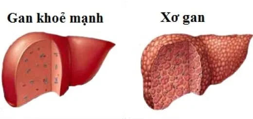 xo-gan