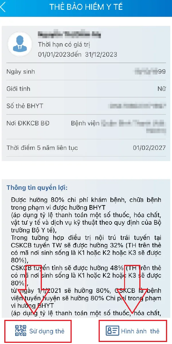 quen-the-bhyt-co-3-cach-thay-the-02