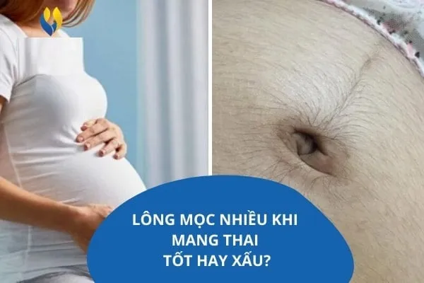 Các chuyên gia cho biết việc mọc lông bụng khi mang thai là một hiện tượng sinh lý bình thường và không ảnh hưởng đến sức khỏe của mẹ và bé. 