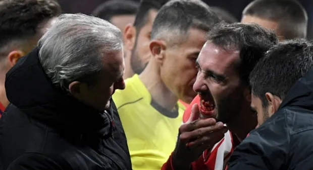 Godin phải trồng lại răng sau chiến thắng của Atletico - Bóng Đá