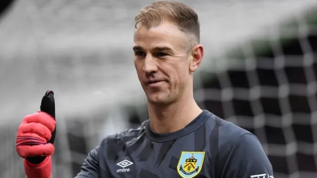 XONG! Joe Hart không có 