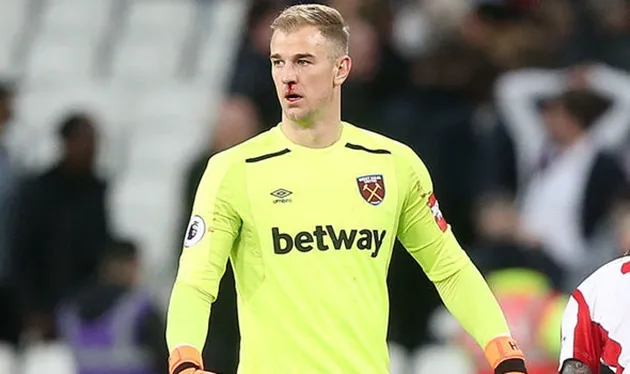 Blackburn theo đuổi Joe Hart - Bóng Đá