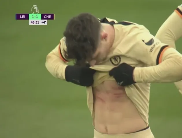 Những hình ảnh phản cảm xuất hiện trong trận Leicester - Chelsea - Bóng Đá