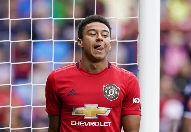 Manchester United star a doubt for England after  - Lingard - Bóng Đá