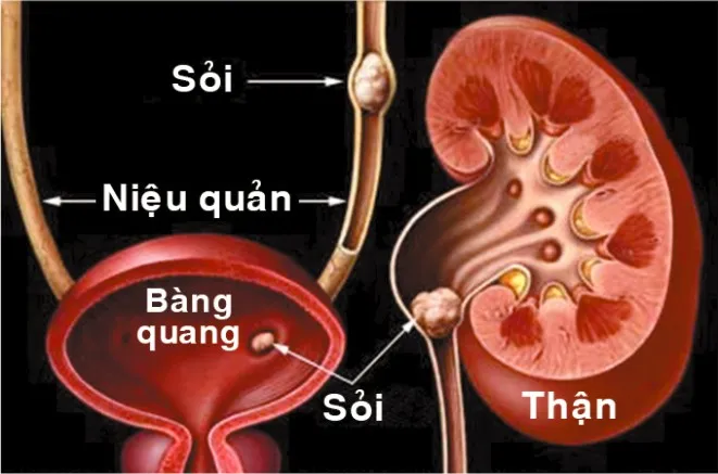 soi-than1