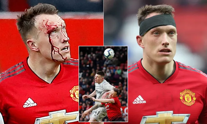 Phil Jones 'đổ máu' là điều cần thiết với Man Utd thời điểm này - Bóng Đá