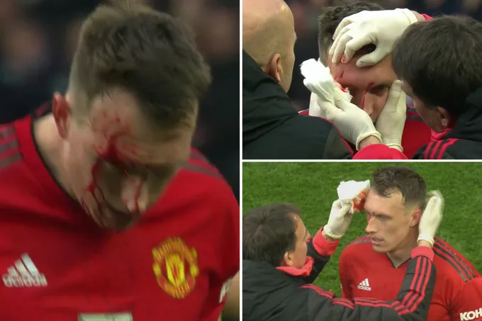 Phil Jones 'đổ máu' là điều cần thiết với Man Utd thời điểm này - Bóng Đá