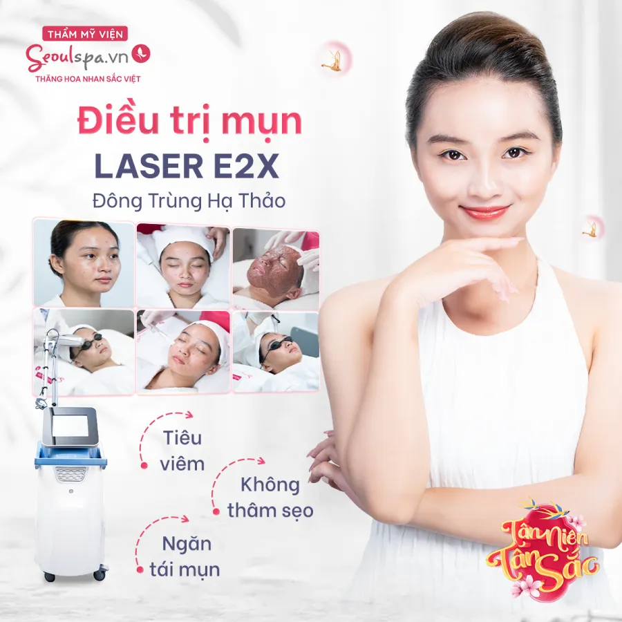 Điều trị mụn E2X Đông Trùng Hạ Thảo tại SeoulSpa.Vn không chỉ giúp da giảm viêm, hết mụn mà còn ngăn ngừa sẹo, ngăn ngừa mụn tái phát